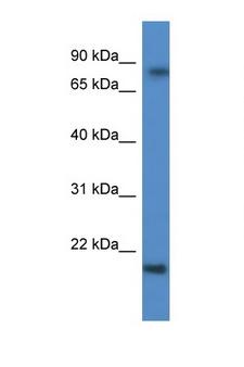 KRTAP1-5 Antibody - KRTAP1-5 antibody Western blot of Fetal Brain lysate. Antibody concentration 1 ug/ml.  This image was taken for the unconjugated form of this product. Other forms have not been tested.