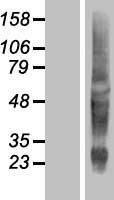 KRTAP10-11 Protein - Western validation with an anti-DDK antibody * L: Control HEK293 lysate R: Over-expression lysate