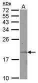 KRTAP11-1 Antibody - Sample (30 ug of whole cell lysate) A: Jurkat 12% SDS PAGE KRTAP11-1 antibody diluted at 1:500