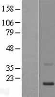 KRTAP11-1 Protein - Western validation with an anti-DDK antibody * L: Control HEK293 lysate R: Over-expression lysate