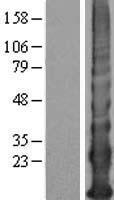 KRTAP12-4 Protein - Western validation with an anti-DDK antibody * L: Control HEK293 lysate R: Over-expression lysate