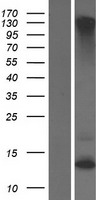 KRTAP2-2 Protein - Western validation with an anti-DDK antibody * L: Control HEK293 lysate R: Over-expression lysate