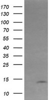 KRTAP2-4 Antibody - HEK293T cells were transfected with the pCMV6-ENTRY control (Left lane) or pCMV6-ENTRY KRTAP2 (Right lane) cDNA for 48 hrs and lysed. Equivalent amounts of cell lysates (5 ug per lane) were separated by SDS-PAGE and immunoblotted with anti-KRTAP2.