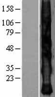 KRTAP2-4 Protein - Western validation with an anti-DDK antibody * L: Control HEK293 lysate R: Over-expression lysate