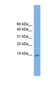 KRTAP23-1 Antibody - KRTAP23-1 antibody Western blot of HepG2 cell lysate. This image was taken for the unconjugated form of this product. Other forms have not been tested.