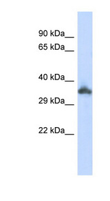 KRTAP24-1 Antibody - KRTAP24-1 antibody Western blot of 293T cell lysate. This image was taken for the unconjugated form of this product. Other forms have not been tested.