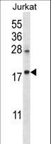 KRTAP25-1 Antibody - KRTAP25-1 Antibody western blot of Jurkat cell line lysates (35 ug/lane). The KRTAP25-1 antibody detected the KRTAP25-1 protein (arrow).