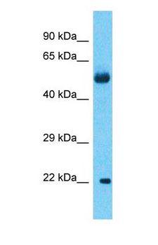 KRTAP27-1 Antibody - Western blot of KRTAP27-1 Antibody with Lung Tumor lysate.  This image was taken for the unconjugated form of this product. Other forms have not been tested.