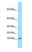 KRTAP3-3 Antibody - KRTAP3-3 antibody Western Blot of Mouse Spleen.  This image was taken for the unconjugated form of this product. Other forms have not been tested.