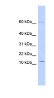 KRTAP8-1 Antibody - KRTAP8-1 antibody Western blot of Fetal Heart lysate. This image was taken for the unconjugated form of this product. Other forms have not been tested.