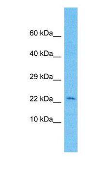 KRTAP9-2 Antibody - Western blot of KRA92 Antibody with human MCF7 Whole Cell lysate.  This image was taken for the unconjugated form of this product. Other forms have not been tested.
