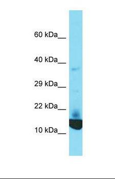 KRTCAP2 Antibody - Western blot of Human Jurkat. KRTCAP2 antibody dilution 1.0 ug/ml.  This image was taken for the unconjugated form of this product. Other forms have not been tested.