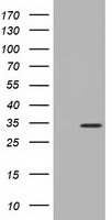 KSP32 / MIOX Antibody - HEK293T cells were transfected with the pCMV6-ENTRY control (Left lane) or pCMV6-ENTRY MIOX (Right lane) cDNA for 48 hrs and lysed. Equivalent amounts of cell lysates (5 ug per lane) were separated by SDS-PAGE and immunoblotted with anti-MIOX.