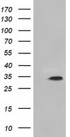 KSP32 / MIOX Antibody - HEK293T cells were transfected with the pCMV6-ENTRY control (Left lane) or pCMV6-ENTRY MIOX (Right lane) cDNA for 48 hrs and lysed. Equivalent amounts of cell lysates (5 ug per lane) were separated by SDS-PAGE and immunoblotted with anti-MIOX.