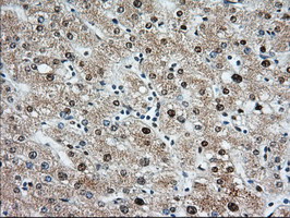 KSP32 / MIOX Antibody - IHC of paraffin-embedded Human liver tissue using anti-MIOX mouse monoclonal antibody.
