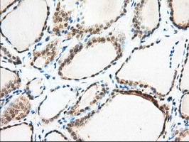 KSP32 / MIOX Antibody - IHC of paraffin-embedded Human thyroid tissue using anti-MIOX mouse monoclonal antibody.
