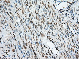 KSP32 / MIOX Antibody - IHC of paraffin-embedded Human endometrium tissue using anti-MIOX mouse monoclonal antibody.