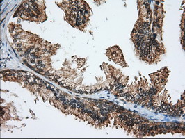 KSP32 / MIOX Antibody - IHC of paraffin-embedded Human prostate tissue using anti-MIOX mouse monoclonal antibody.