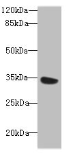 KSP32 / MIOX Antibody - Western blot All lanes: MIOX antibody at 6µg/ml + Mouse kidney tissue Secondary Goat polyclonal to rabbit IgG at 1/10000 dilution Predicted band size: 34, 25 kDa Observed band size: 34 kDa