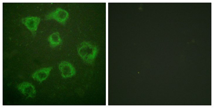 KSR1 Antibody - Immunofluorescence analysis of HUVEC cells, using KSR Antibody. The picture on the right is blocked with the synthesized peptide.