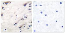 KSR1 Antibody - Immunohistochemistry analysis of paraffin-embedded human brain tissue, using KSR Antibody. The picture on the right is blocked with the synthesized peptide.