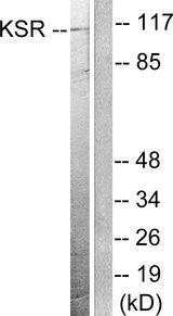 KSR1 Antibody - Western blot analysis of lysates from NIH/3T3 cells, treated with PDGF 50ng/ml 20', using KSR Antibody. The lane on the right is blocked with the synthesized peptide.