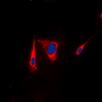 KSR1 Antibody - Immunofluorescent analysis of KSR1 staining in HEK293T cells. Formalin-fixed cells were permeabilized with 0.1% Triton X-100 in TBS for 5-10 minutes and blocked with 3% BSA-PBS for 30 minutes at room temperature. Cells were probed with the primary antibody in 3% BSA-PBS and incubated overnight at 4 deg C in a humidified chamber. Cells were washed with PBST and incubated with a DyLight 594-conjugated secondary antibody (red) in PBS at room temperature in the dark. DAPI was used to stain the cell nuclei (blue).