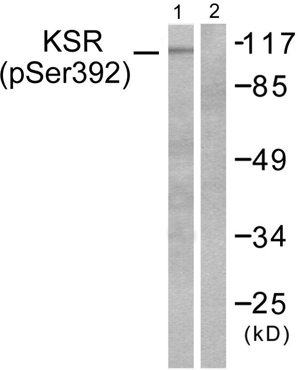 KSR1 Antibody - Western blot analysis of extracts from HepG2 cells, using KSR (phospho-Ser392) antibody.