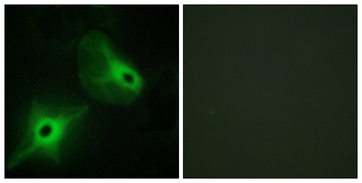 KSR2 Antibody - Immunofluorescence analysis of HeLa cells, using KSR2 Antibody. The picture on the right is blocked with the synthesized peptide.