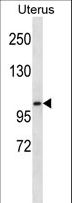 KSR2 Antibody - Mouse Ksr2 Antibody western blot of human normal Uterus tissue lysates (35 ug/lane). The Ksr2 antibody detected the Ksr2 protein (arrow).