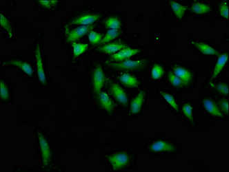KSR2 Antibody - Immunofluorescence staining of Hela cells at a dilution of 1:100, counter-stained with DAPI. The cells were fixed in 4% formaldehyde, permeabilized using 0.2% Triton X-100 and blocked in 10% normal Goat Serum. The cells were then incubated with the antibody overnight at 4 °C.The secondary antibody was Alexa Fluor 488-congugated AffiniPure Goat Anti-Rabbit IgG (H+L) .