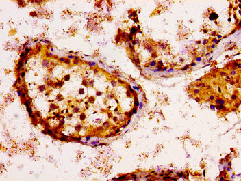 KSR2 Antibody - Immunohistochemistry image at a dilution of 1:100 and staining in paraffin-embedded human testis tissue performed on a Leica BondTM system. After dewaxing and hydration, antigen retrieval was mediated by high pressure in a citrate buffer (pH 6.0) . Section was blocked with 10% normal goat serum 30min at RT. Then primary antibody (1% BSA) was incubated at 4 °C overnight. The primary is detected by a biotinylated secondary antibody and visualized using an HRP conjugated SP system.