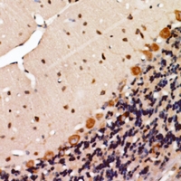 KSR2 Antibody - Immunohistochemical analysis of KSR2 staining in human brain formalin fixed paraffin embedded tissue section. The section was pre-treated using heat mediated antigen retrieval with sodium citrate buffer (pH 6.0). The section was then incubated with the antibody at room temperature and detected using an HRP conjugated compact polymer system. DAB was used as the chromogen. The section was then counterstained with haematoxylin and mounted with DPX.