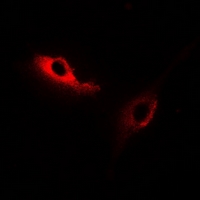 KSR2 Antibody - Immunofluorescent analysis of KSR2 staining in HeLa cells. Formalin-fixed cells were permeabilized with 0.1% Triton X-100 in TBS for 5-10 minutes and blocked with 3% BSA-PBS for 30 minutes at room temperature. Cells were probed with the primary antibody in 3% BSA-PBS and incubated overnight at 4 °C in a hidified chamber. Cells were washed with PBST and incubated with Alexa Fluor 647-conjugated secondary antibody (red) in PBS at room temperature in the dark.