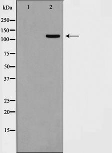 KSR2 Antibody - Western blot analysis on 293 cell lysates using KSR2 antibody. The lane on the left is treated with the antigen-specific peptide.