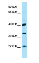 KTI12 Antibody - KTI12 antibody Western Blot of Fetal kidney.  This image was taken for the unconjugated form of this product. Other forms have not been tested.