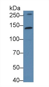 KTN1 / Kinectin Antibody - Western Blot; Sample: Human Hela cell lysate; Primary Ab: 2µg/ml Rabbit Anti-Rat KTN1 Antibody Second Ab: 0.2µg/mL HRP-Linked Caprine Anti-Rabbit IgG Polyclonal Antibody