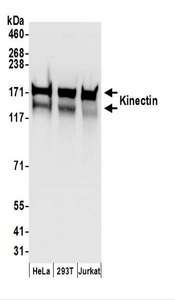 KTN1 / Kinectin Antibody - Detection of Human Kinectin by Western Blot. Samples: Whole cell lysate (50 ug) prepared using NETN buffer from HeLa, 293T, and Jurkat cells. Antibodies: Affinity purified rabbit anti-Kinectin antibody used for WB at 0.1 ug/ml. Detection: Chemiluminescence with an exposure time of 3 seconds.