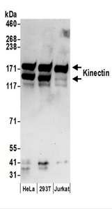 KTN1 / Kinectin Antibody - Detection of Human Kinectin by Western Blot. Samples: Whole cell lysate (50 ug) prepared using NETN buffer from HeLa, 293T, and Jurkat cells. Antibodies: Affinity purified rabbit anti-Kinectin antibody used for WB at 0.1 ug/ml. Detection: Chemiluminescence with an exposure time of 30 seconds.