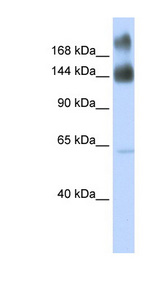 KTN1 / Kinectin Antibody - KTN1 antibody Western blot of Fetal Brain lysate. This image was taken for the unconjugated form of this product. Other forms have not been tested.