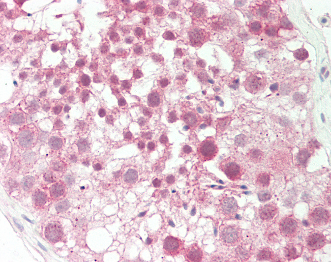 KTN1 / Kinectin Antibody - Human Testis: Formalin-Fixed, Paraffin-Embedded (FFPE).  This image was taken for the unconjugated form of this product. Other forms have not been tested.