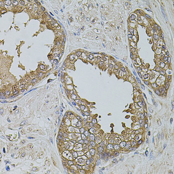 KTN1 / Kinectin Antibody - Immunohistochemistry of paraffin-embedded human prostate tissue.