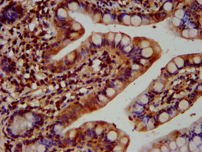 KTN1 / Kinectin Antibody - Immunohistochemistry image at a dilution of 1:400 and staining in paraffin-embedded human small intestine tissue performed on a Leica BondTM system. After dewaxing and hydration, antigen retrieval was mediated by high pressure in a citrate buffer (pH 6.0) . Section was blocked with 10% normal goat serum 30min at RT. Then primary antibody (1% BSA) was incubated at 4 °C overnight. The primary is detected by a biotinylated secondary antibody and visualized using an HRP conjugated SP system.