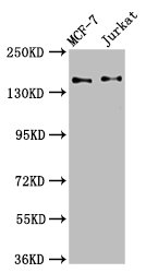 KTN1 / Kinectin Antibody - Positive Western Blot detected in MCF-7 whole cell lysate, Jurkat whole cell lysate. All lanes: KTN1 antibody at 3.4 µg/ml Secondary Goat polyclonal to rabbit IgG at 1/50000 dilution. Predicted band size: 157, 150, 151, 153 KDa. Observed band size: 157 KDa