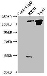 KTN1 / Kinectin Antibody - Immunoprecipitating KTN1 in A549 whole cell lysate Lane 1: Rabbit control IgG instead of KTN1 Antibody in A549 whole cell lysate.For western blotting, a HRP-conjugated Protein G antibody was used as the secondary antibody (1/2000) Lane 2: KTN1 Antibody (6µg) + A549 whole cell lysate (1mg) Lane 3: A549 whole cell lysate (20µg)