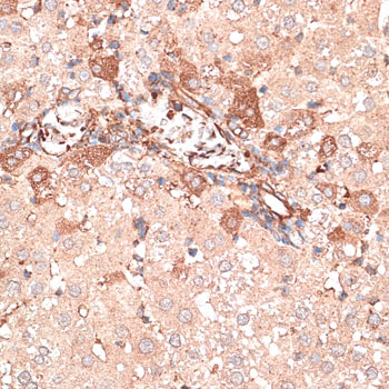 KTN1 / Kinectin Antibody - Immunohistochemistry of paraffin-embedded rat liver using KTN1 antibody at dilution of 1:100 (40x lens).