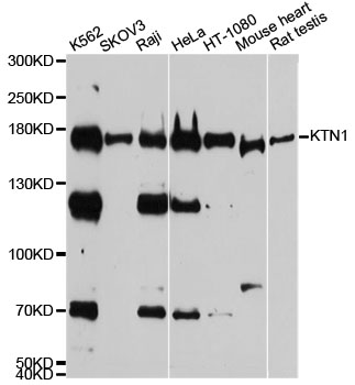 KTN1 / Kinectin Antibody - Western blot analysis of extracts of various cell lines, using KTN1 antibody at 1:1000 dilution. The secondary antibody used was an HRP Goat Anti-Rabbit IgG (H+L) at 1:10000 dilution. Lysates were loaded 25ug per lane and 3% nonfat dry milk in TBST was used for blocking. An ECL Kit was used for detection and the exposure time was 90s.