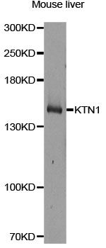 KTN1 / Kinectin Antibody - Western blot analysis of extracts of mouse liver, using KTN1 antibody at 1:1000 dilution. The secondary antibody used was an HRP Goat Anti-Rabbit IgG (H+L) at 1:10000 dilution. Lysates were loaded 25ug per lane and 3% nonfat dry milk in TBST was used for blocking. An ECL Kit was used for detection and the exposure time was 90s.