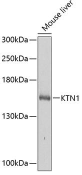 KTN1 / Kinectin Antibody - Western blot analysis of extracts of mouse liver using KTN1 Polyclonal Antibody at dilution of 1:1000.