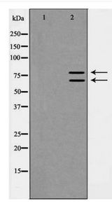 Ku70+Ku80 / XRCC6+XRCC5 Antibody - Western blot of Ku70/80 expression in LoVo cell lysate